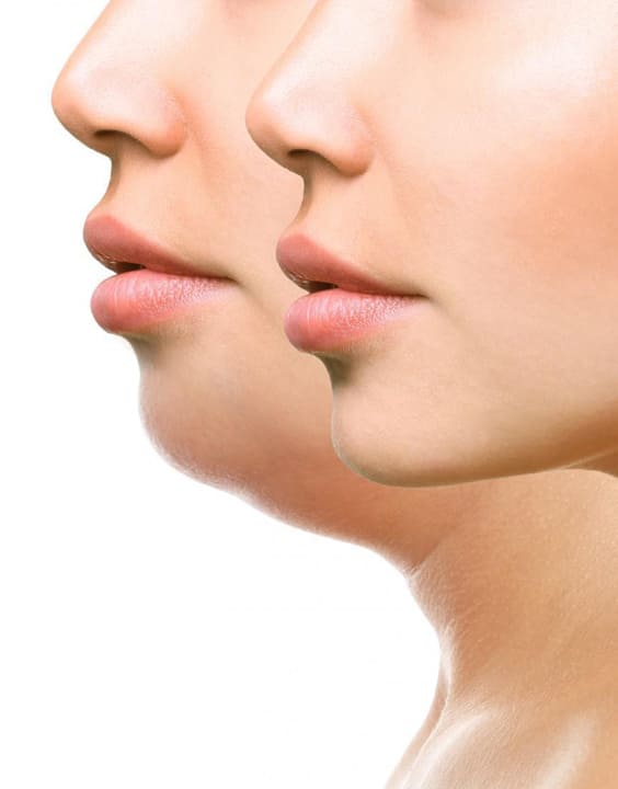 Slim best sale chin exercise