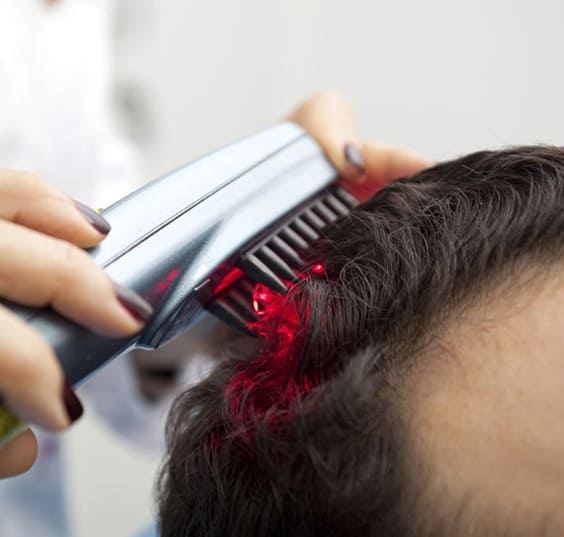 Stem Cell Therapy - tips for hair growth - Bewakoof blog